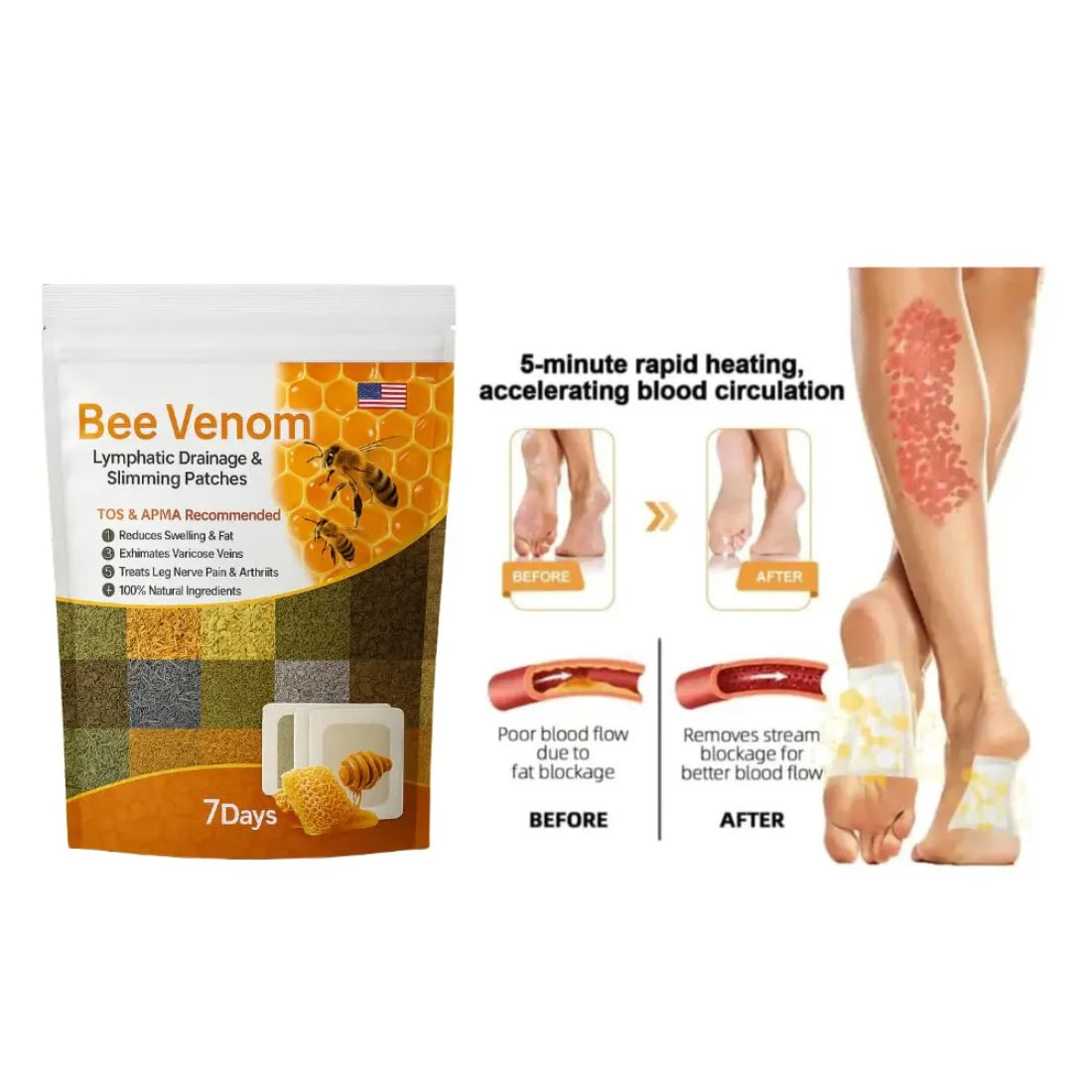 New Bee Venom Patches – Natural Stress Relief & Detox Patch Solution | Relaxation & Wellness Aid